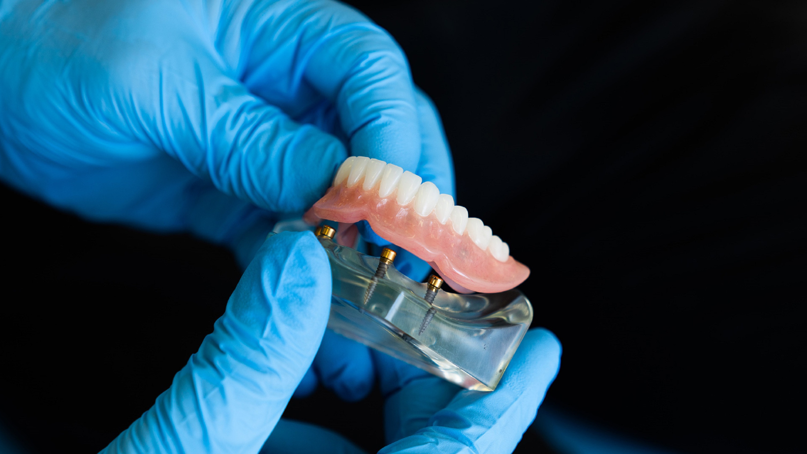dantų protezavimas